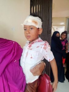 আহত ছাত্র